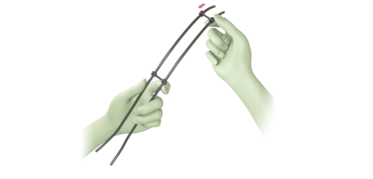 New White Paper: Sublaminar Bands vs. All-Screw Technique