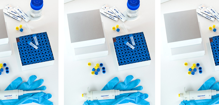 Customized Coumadin via Genetic Testing