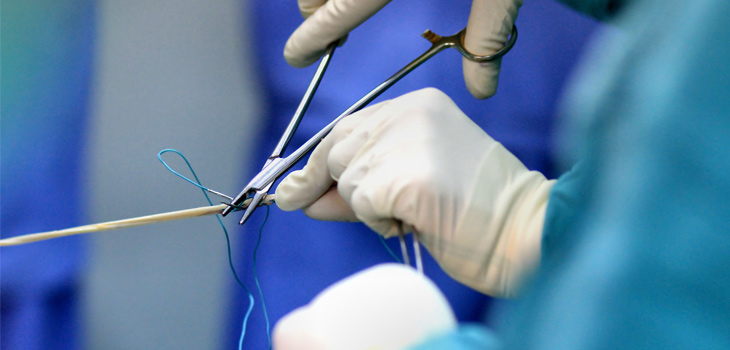 Tissue Regenix, CellRight Team Up to Improve ACL Repair