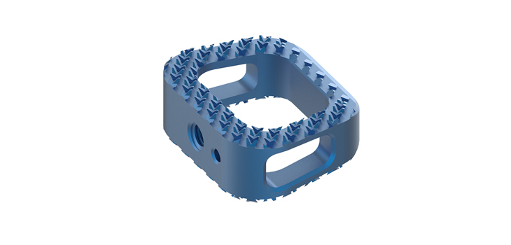 FDA Clears Matisse Titanium Spinal Implant Cage