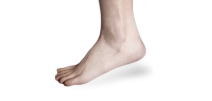 More Research Needed on Chronic Ankle Instability