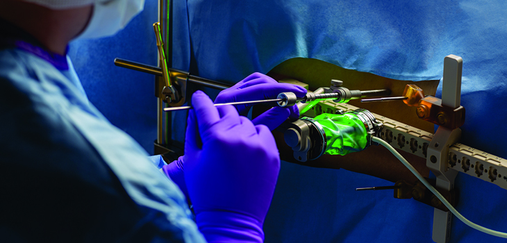 Mazor: First International PROlat Case