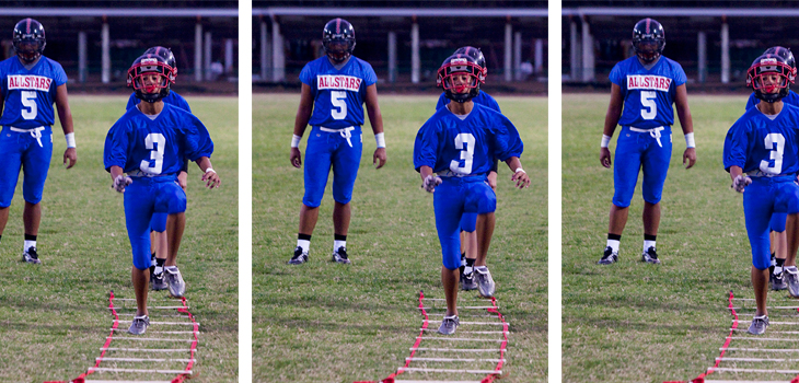 Intra-articular Physeal Fracture Often Missed in Young Athletes