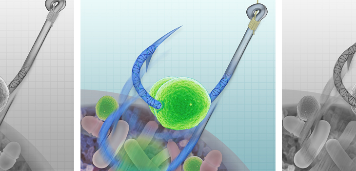 Study: Prebiotics Can Slow OA Progression; Bone Marrow Aspirate Enhances OCA Integration; Multimodal Analgesia Cuts Narcotic Use