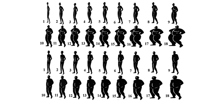 Obese Benefit Equally From Joint Replacement