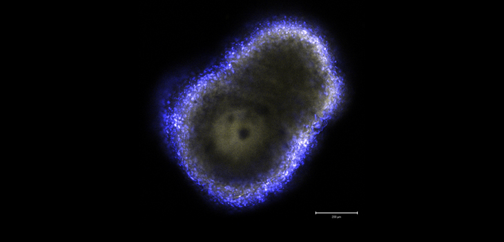 After 8 Years, Stem Cells Are Still Rehydrating Discs