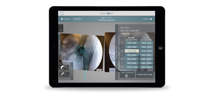 JointPoint, DePuy Synthes Sign Exclusive Agreement