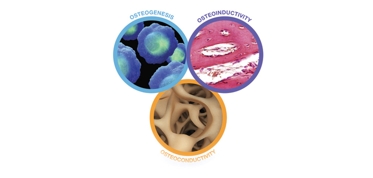 Matt Lyons’ Venture, Extremity Medical, Next Gen Bone Cell Graft