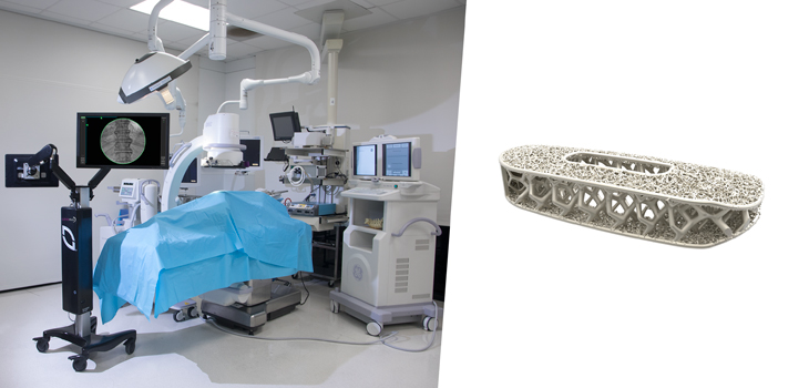 NuVasive’s Commitment to Expandables, New Materials and Systems