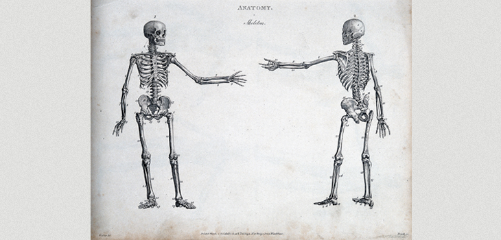 Arthritis Prevalence 69% Higher Than Previously Thought