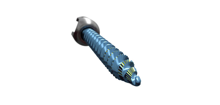 Stryker Spine Launches Serrato Pedicle Screw