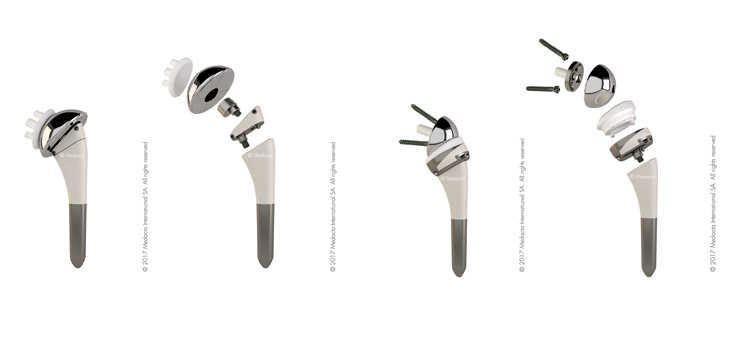 Medacta Anatomic and Reverse Shoulder Components Cleared