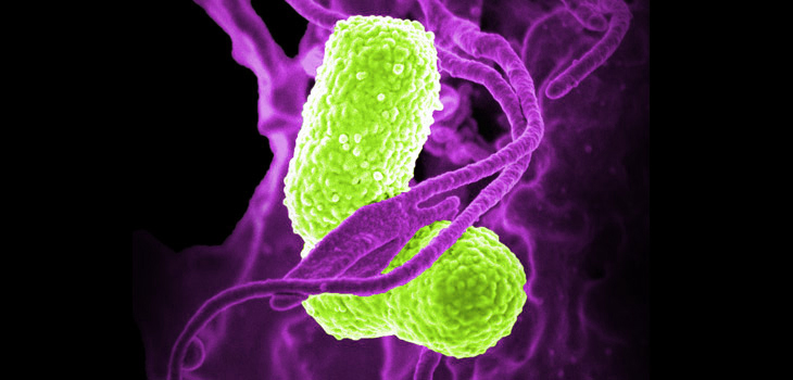 Periprosthetic Joint Infections on the Rise?!
