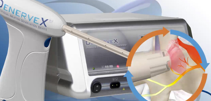 Medovex Corp Submits Facet Pain Relief IDE