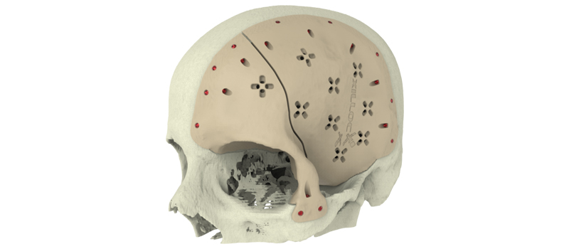 FDA Steps Up AND INTO the 3D Printing Revolution