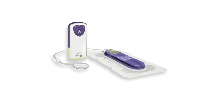 PREVENA Helps Reduce SSIs, Complications