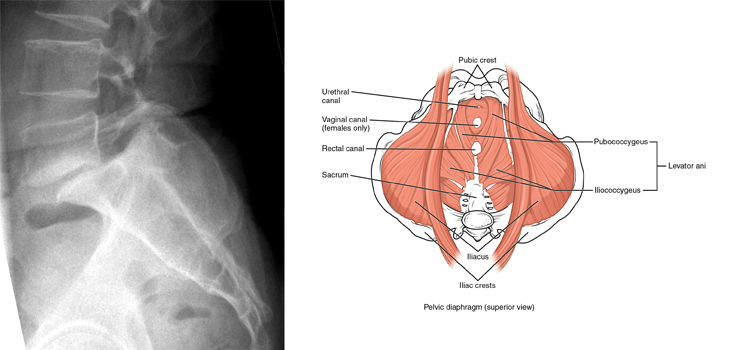 Missing Spondy/Pelvic Floor Muscle Link; $6 Million for Bone Infection Research; OrthoCarolina Adds 40th Location