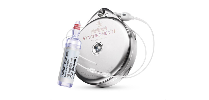 Approved Medtronic Pain Pump Reduces Systemic Opioid Use