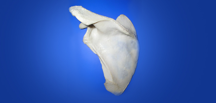 Glenoid Bone Loss Estimates…Unreliable