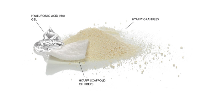 FDA Clears Anika Therapeutics’ HA Bone Void Filler