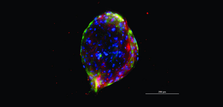 Stem Cells to Regrow Bone in Israeli Trial