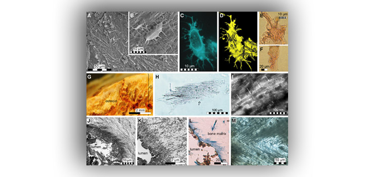 Scientists Develop New Bone Growth Method