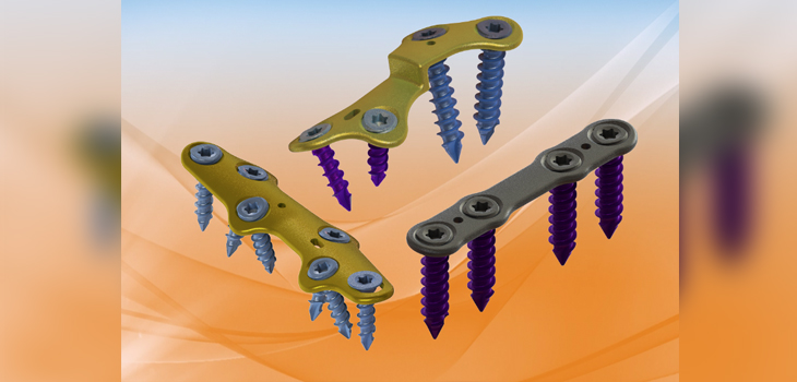 FDA Quickly Clears Foot and Ankle Plating System