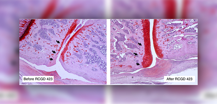 USC Research Finds Cartilage Growth Regulator