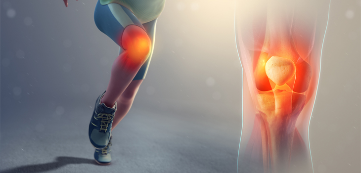Stem Cell Injections Treating Sports-Related Pain