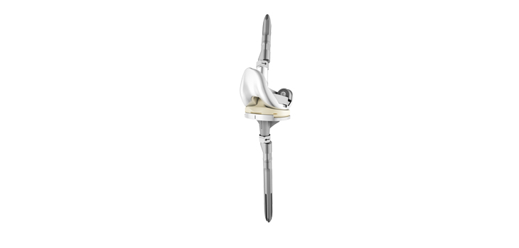 DePuy Synthes Launches ATTUNE Revision Knee