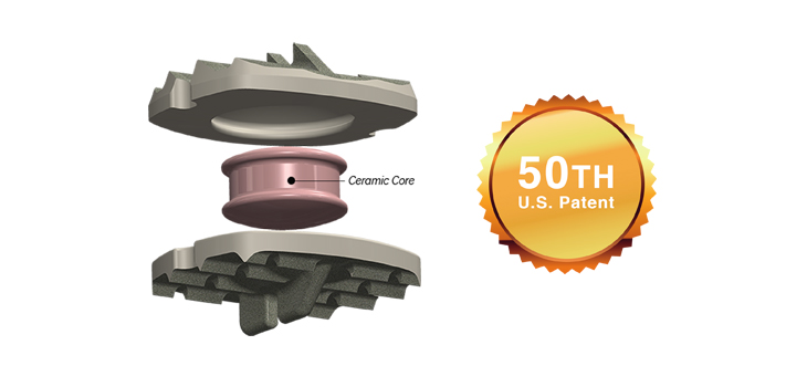 Simplify Medical Earns 50th U.S. Patent