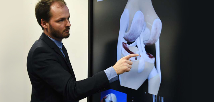 French Bio-Printing New Knee Prosthesis