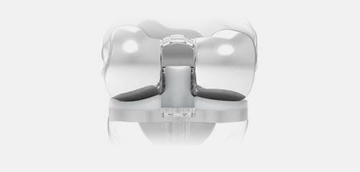 ConforMIS Awarded “3A” Rating in the UK