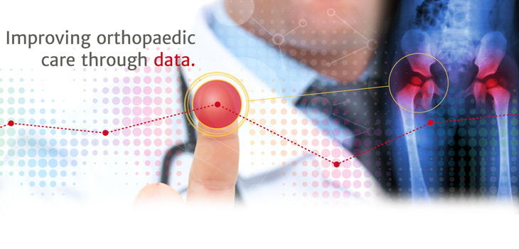 AJRR: Study on Hospital Size, Revision Procedure Correlation