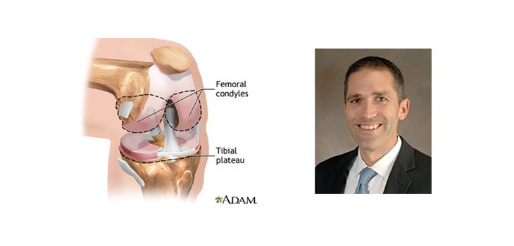 Linking Soft Tissue Injuries to Fracture Fixation Outcomes