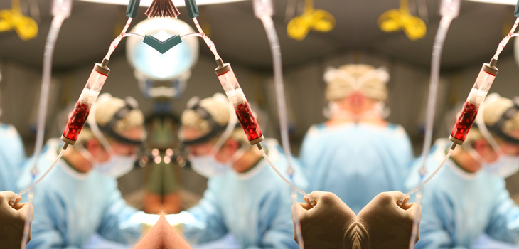 Higher Risks for Asian Patients Undergoing TKA?