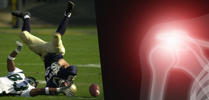 Trauma Responsible for Most Coracoid Fractures in Sports
