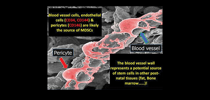 New Ortho Stem Cell Discovery; AAOS Diversity Award Winner; Silver Nylon Cuts Infection Rates