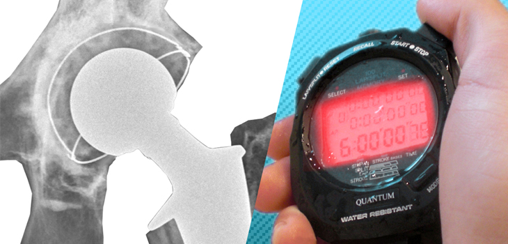 Six Hours and Home for Joint Replacement