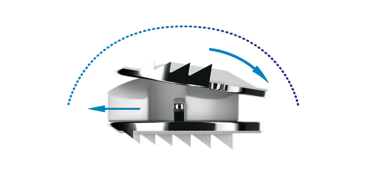 Mobi-C: Lower Pain, Less Adjacent Level Degeneration