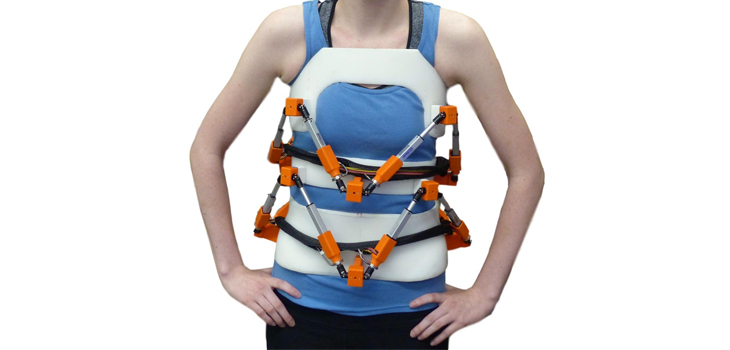 Robotic Exoskeleton to Revolutionize Bracing