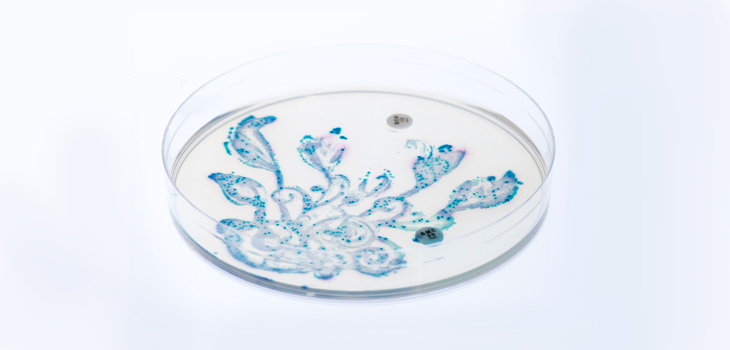 Wild Garden of Gut Bacteria Cuts OA in Obese Patients!!