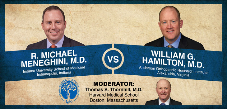 Meneghini v. Hamilton: Posterior Stabilized Knee Designs: Vestigial Organs