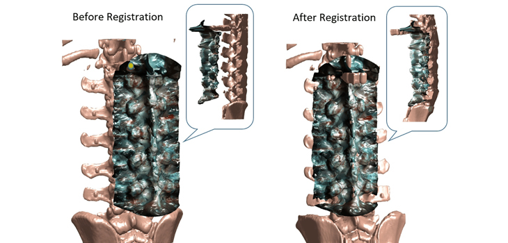 Stereoscopic Spine Imaging!