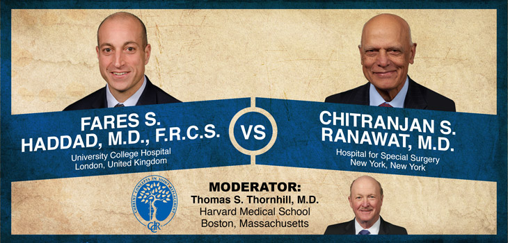 Haddad v Ranawat: The Medial Stabilized Knee: The “Post-Cam” Replacement