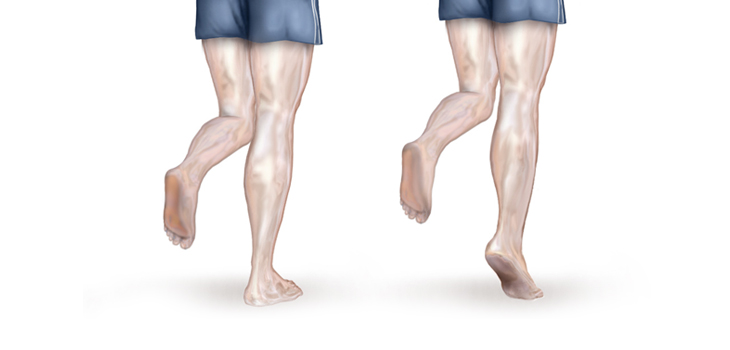 One-Legged Jumps Increase Bone Strength…and Fast!