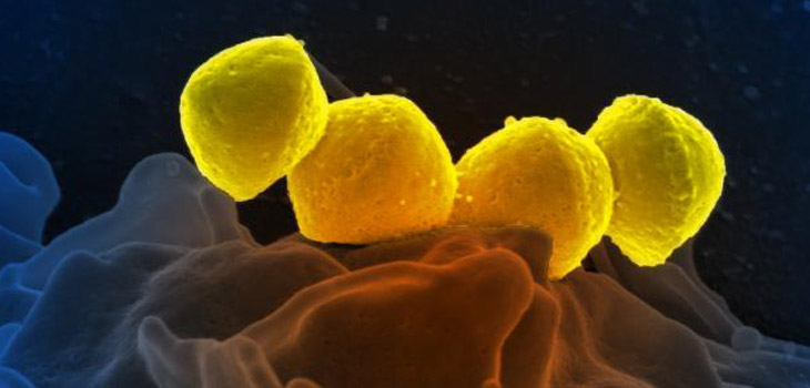 Infection Breakthrough at Rothman