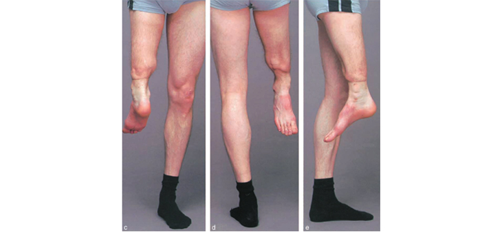 British Doctors Reattach Child’s Severed Leg Backwards