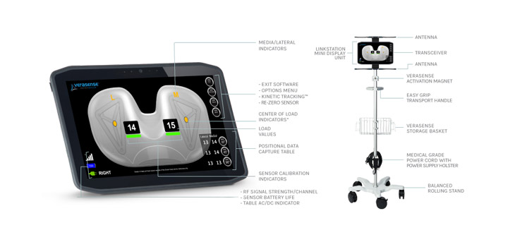 OrthoSensor Device Cleared for Persona Knee System