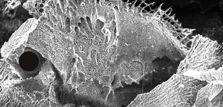 New Bone Remodeling Approach With Silk Tested